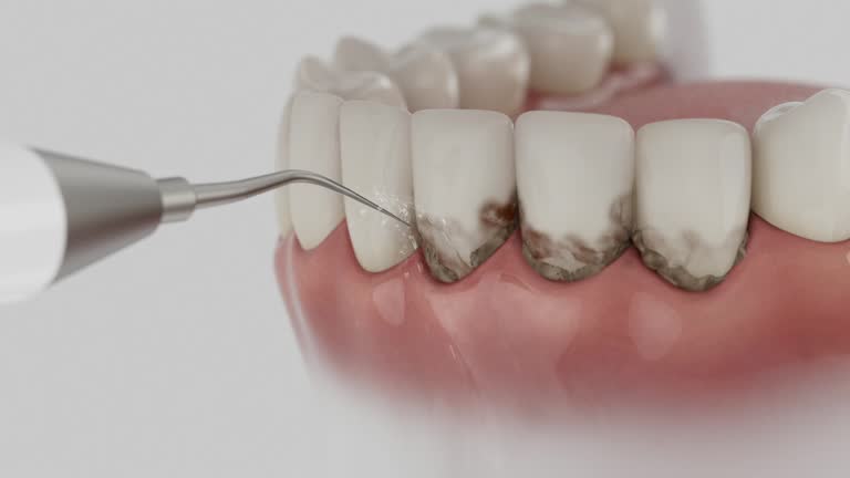 Reliable Dental contractor in Edgewood, IN by Dentist Open Now